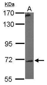 Sample (50 ug of whole cell lysate). A: Mouse brain. 7.5% SDS PAGE. GALNT7 antibody diluted at 1:5000.