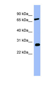 COMT antibody LS-C107721 Western blot of Fetal Stomach lysate.