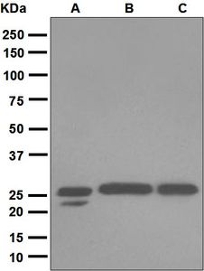 Western blot analysis on (A) fetal liver, (B) A431, and (C) Molt-4 lysates using anti-COMT antibody.