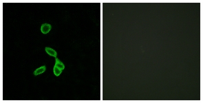 Immunofluorescence of LOVO cells, using GALR1 Antibody. The picture on the right is treated with the synthesized peptide.