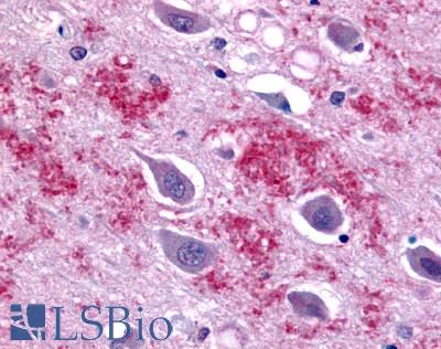 Anti-GALR1 antibody LS-A4013 IHC of human brain. Immunohistochemistry of formalin-fixed, paraffin-embedded tissue after heat-induced antigen retrieval.