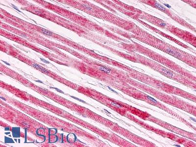 Anti-Galanin Receptor 1 / GALR1 antibody IHC of human heart, myocardium. Immunohistochemistry of formalin-fixed, paraffin-embedded tissue after heat-induced antigen retrieval. Antibody LS-A6168 dilution 100 ug/ml.