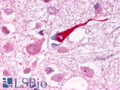 Anti-Galanin Receptor 1 / GALR1 antibody IHC of human brain, hypothalamus arcuate nucleus. Immunohistochemistry of formalin-fixed, paraffin-embedded tissue after heat-induced antigen retrieval. Antibody LS-A6168 dilution 100 ug/ml.
