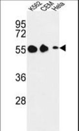 Western blot of GALR1 Antibody in K562, CEM, HeLa cell line lysates (35 ug/lane). GALR1 (arrow) was detected using the purified antibody.