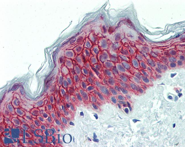 Anti-GALR2 antibody IHC of human skin. Immunohistochemistry of formalin-fixed, paraffin-embedded tissue after heat-induced antigen retrieval. Antibody LS-B4081 concentration 10 ug/ml.