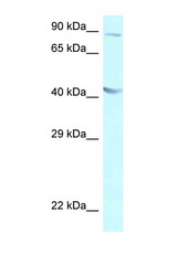 GALR2 antibody LS-C145625 Western blot of A549 Cell lysate. Antibody concentration 1 ug/ml.