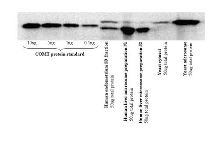 WB: Serum Characterization by Western Blot