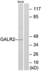 Western blot of extracts from RAW264.7 cells, using GALR2 Antibody. The lane on the right is treated with the synthesized peptide.