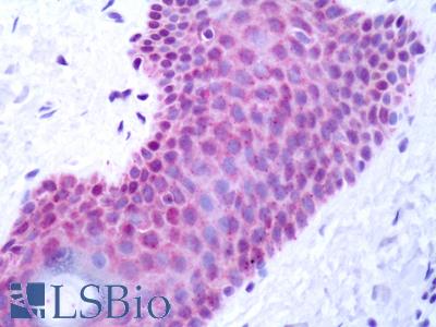 Human Skin: Formalin-Fixed, Paraffin-Embedded (FFPE)