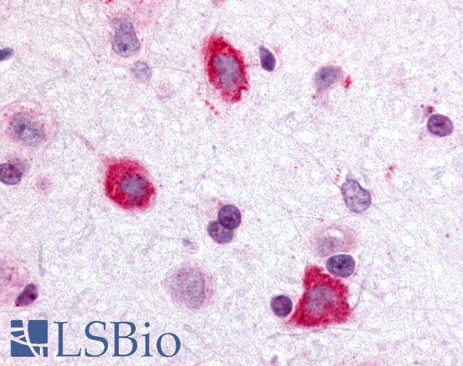 Anti-GALR3 antibody LS-A205 IHC of rat brain, hippocampus. Immunohistochemistry of formalin-fixed, paraffin-embedded tissue after heat-induced antigen retrieval.