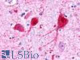 Anti-GALR3 antibody LS-A204 IHC of human brain, neurons and glia. Immunohistochemistry of formalin-fixed, paraffin-embedded tissue after heat-induced antigen retrieval.