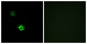 Immunofluorescence of A549 cells, using GALR3 Antibody. The picture on the right is treated with the synthesized peptide.
