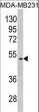Western blot of GALT Antibody in MDA-MB231 cell line lysates (35 ug/lane). GALT (arrow) was detected using the purified antibody.