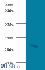 Western blot of Guanidinoacetate N-methyltransferase antibody at 2 ug/ml with 293T Secondary Goat polyclonal to Rabbit IgG at 1:10000 dilution.