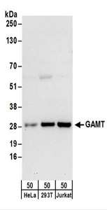 Detection of Human GAMT by Western Blot. Samples: Whole cell lysate (50 ug) from HeLa, 293T, and Jurkat cells. Antibodies: Affinity purified rabbit anti-GAMT antibody used for WB at 0.4 ug/ml. Detection: Chemiluminescence with an exposure time of 30 seconds.