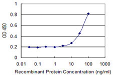 Detection limit for recombinant GST tagged GAMT is 1 ng/ml as a capture antibody.