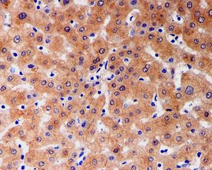 IHC of paraffin-embedded human liver tissue using anti-GAMT antibody.