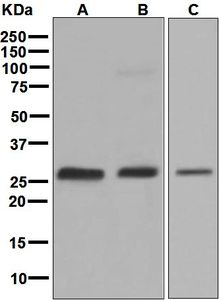 Western blot analysis on (A) fetal liver, (B) HepG2, and (C) SH-SY5Y lysates using anti-GAMT antibody.