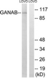 Western blot of extracts from LOVO cells, using GANAB Antibody. The lane on the right was incubated with synthetic peptide.