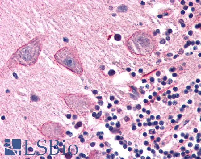 Anti-COMT antibody LS-A9797 IHC of human brain, cerebellum. Immunohistochemistry of formalin-fixed, paraffin-embedded tissue after heat-induced antigen retrieval.