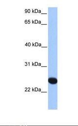 Fetal liver lysate. Antibody concentration: 1.0 ug/ml. Gel concentration: 12%.