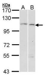 Sample (30 ug of whole cell lysate). A: Hela, B: Molt-4 . 7.5% SDS PAGE. GANAB / Alpha Glucosidase II antibody diluted at 1:1000.