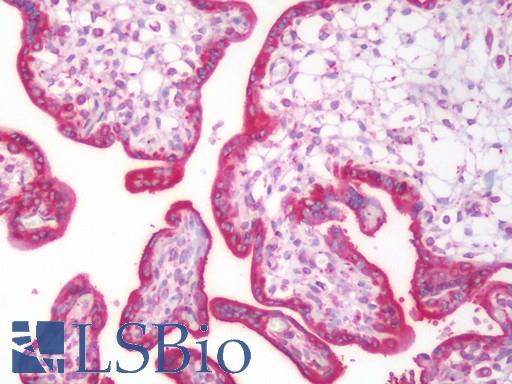 Human Placenta: Formalin-Fixed, Paraffin-Embedded (FFPE)