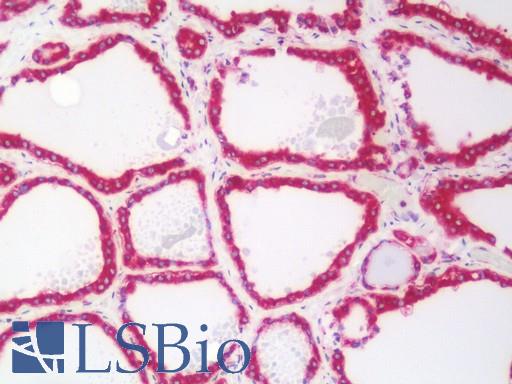 Human Thyroid: Formalin-Fixed, Paraffin-Embedded (FFPE)