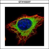 Confocal immunofluorescence analysis (Olympus FV10i) of methanol-fixed HeLa using alpha Glucosidase II antibody (Green) at 1:500 dilution. Alpha-tubulin filaments were labeled with alpha-tubulin antibody (Red) at 1:2000.