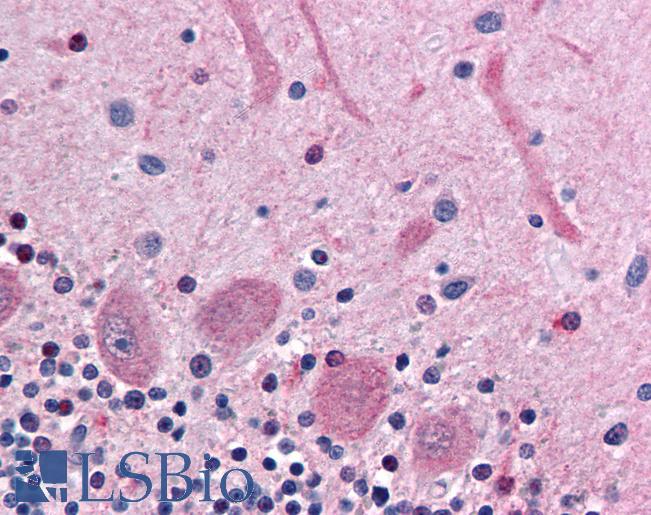 Human, Prostate: Formalin-Fixed Parafin-Embedded (FFPE)
