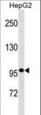 GANC Antibody western blot of HepG2 cell line lysates (35 ug/lane). The GANC antibody detected the GANC protein (arrow).