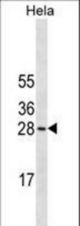 COMT Antibody (Ascites)western blot of HeLa cell line lysates (35 ug/lane). The COMT antibody detected the COMT protein (arrow).