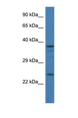 GAP43 antibody LS-C145461 Western blot of 293T Cell lysate. Antibody concentration 1 ug/ml.