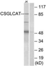 Western blot of extracts from Jurkat cells, using CSGLCAT Antibody. The lane on the right is treated with the synthesized peptide.