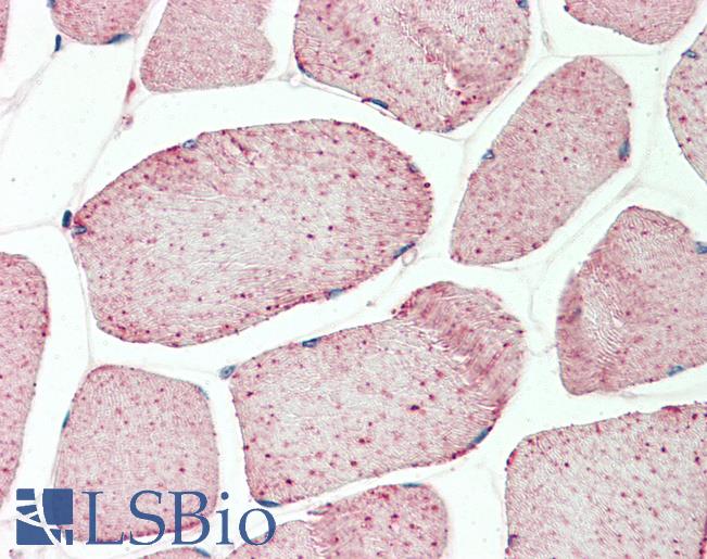 Anti-GAPDH antibody IHC staining of human skeletal muscle. Immunohistochemistry of formalin-fixed, paraffin-embedded tissue after heat-induced antigen retrieval. Antibody LS-B10308 concentration 10 ug/ml.