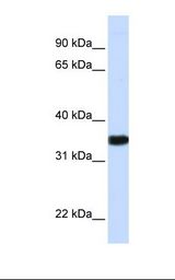 Fetal brain lysate. Antibody concentration: 1.0 ug/ml. Gel concentration: 12%.