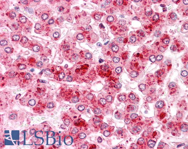 Anti-COMT antibody LS-A8831 IHC of human liver. Immunohistochemistry of formalin-fixed, paraffin-embedded tissue after heat-induced antigen retrieval.