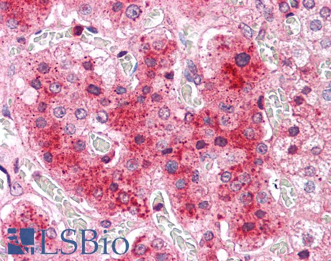 Anti-COMT antibody LS-A8831 IHC of human adrenal. Immunohistochemistry of formalin-fixed, paraffin-embedded tissue after heat-induced antigen retrieval.