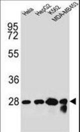 CHPT1 Antibody western blot of HeLa,HepG2,K562,MDA-MB453 cell line lysates (35 ug/lane). The CHPT1 antibody detected the CHPT1 protein (arrow).
