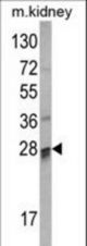 Western blot of COMTD1 Antibody in mouse kidney tissue lysates (35 ug/lane). COMTD1 (arrow) was detected using the purified antibody.