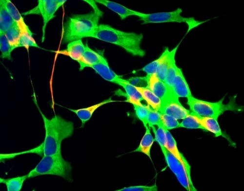 Immunofluorescent staining using GAPDHS antibody. Human neuroblastoma SH-SY5Y cells stained with mouse anti-GAPDH (green), chicken antibody to neurofilament NFH (red) and DNA (blue)