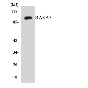 Western blot of the lysates from HUVEC cells using RASA3 antibody.