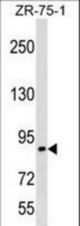 RASA3 Antibody western blot of ZR-75-1 cell line lysates (35 ug/lane). The RASA3 antibody detected the RASA3 protein (arrow).