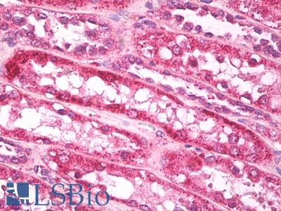 Anti-GAREM / FAM59A antibody IHC of human kidney. Immunohistochemistry of formalin-fixed, paraffin-embedded tissue after heat-induced antigen retrieval. Antibody LS-B7951 dilution 5 ug/ml.