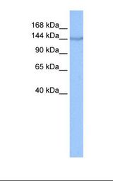 Hela cell lysate. Antibody concentration: 0.5 ug/ml. Gel concentration: 6%-18%.