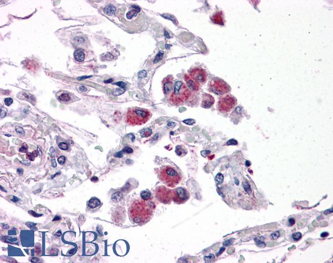 Anti-FAM59B antibody IHC of human lung. Immunohistochemistry of formalin-fixed, paraffin-embedded tissue after heat-induced antigen retrieval. Antibody LS-B4621 concentration 5 ug/ml.