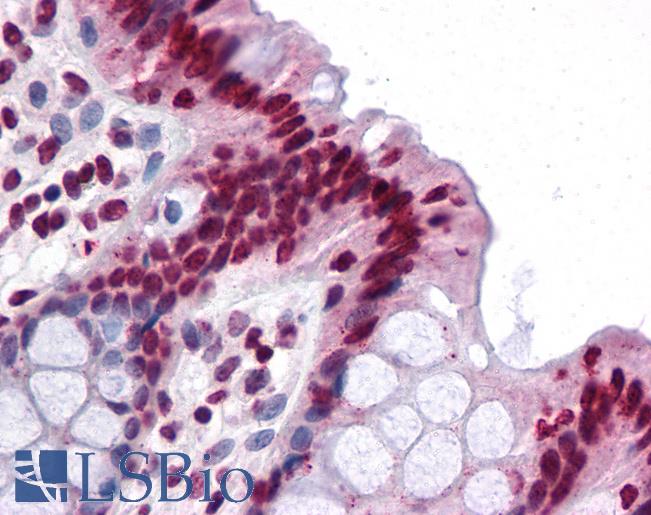 Anti-FAM59B antibody IHC of human colon. Immunohistochemistry of formalin-fixed, paraffin-embedded tissue after heat-induced antigen retrieval. Antibody LS-B4621 concentration 5 ug/ml.