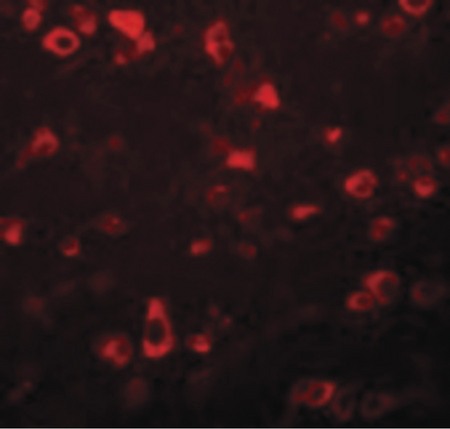 Immunofluorescence of FAM59B in Human Brain cells with FAM59B antibody at 20 ug/ml.