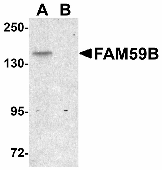 Western blot of FAM59B in SK-N-SH cell lysate with FAM59B antibody at 1 ug/ml in (A) the absence and (B) the presence of blocking peptide.
