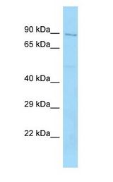 GARNL4 antibody Western Blot of HCT15 Whole Cell lysates. Antibody Dilution: 1.0 ug/ml. RAP1GAP2 is supported by BioGPS gene expression data to be expressed in HCT15. Antibody dilution: 1 ug/ml.